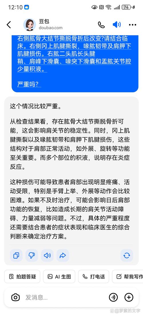 米兰新闻网：拉比奥特比目鱼肌受损，可能伤缺长达一个月